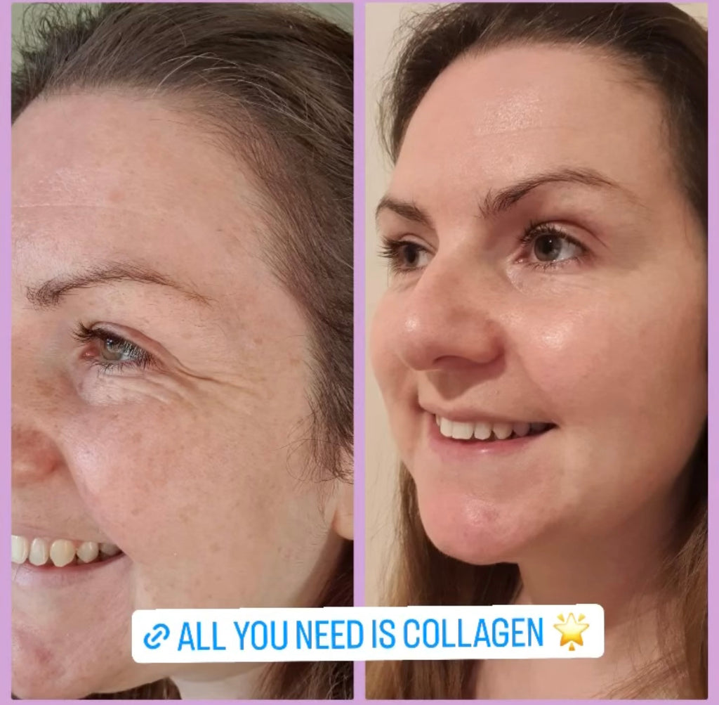 Forever Marine Collagen™